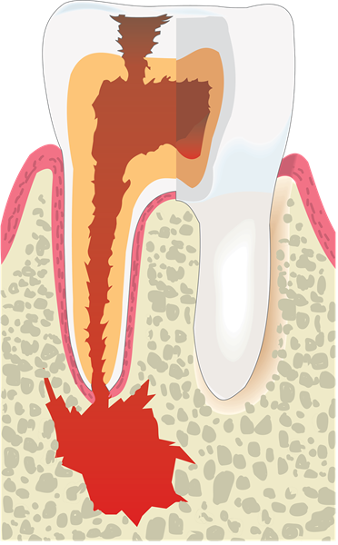 Legal Issues in Endodontics