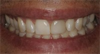 #SmileStories: Who Says Single Centrals Are Impossible to Match?