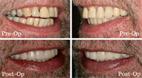 Dr. John Nosti: How Occlusion Affected Me 