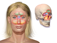 Odontogenic Sinusitis - An Introduction