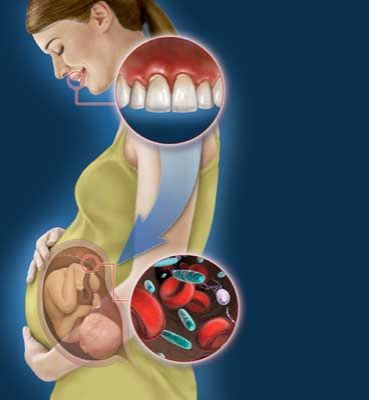 It's More Than All About the Tooth. We are Saving Patient's Lives.