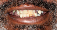 15 Oral Hygiene Tips To Help Engage Your Patients!!