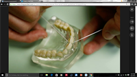 Floss Death Blow?