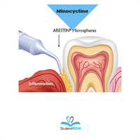 What is the active ingredient of Arestin?