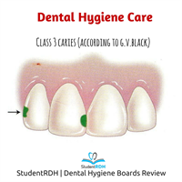 According to the G.V. Black classification, a class III lesion is on: