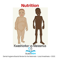 Q: Which disease is related to severe protein deficiency and is characterized by edema?