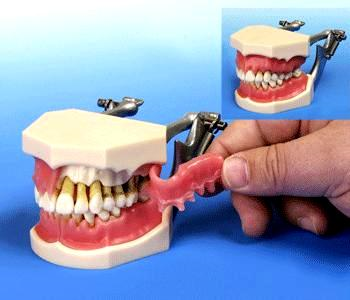 HYGIENE MODELS AND PERIODONTAL MODEL AT BUYAMAG INC ARE IMPORTANT EDUCATION RESOURCES FOR DENTISTRY EDUCATION SCHOOLS PROGRAM 