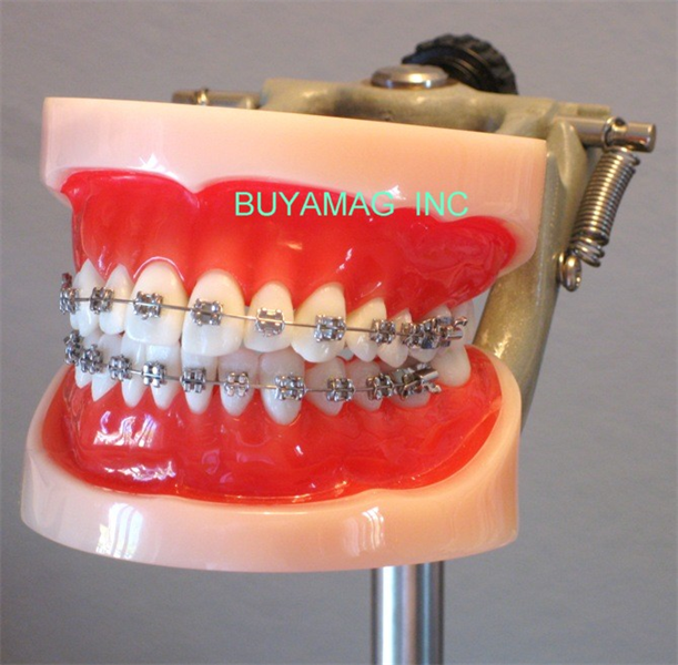ORTHODONTIC MODELS ARE IMPORTANT PRACTICE BUILDING RESOURCE FOR ORTHODONTIC OFFICE DOCTORS