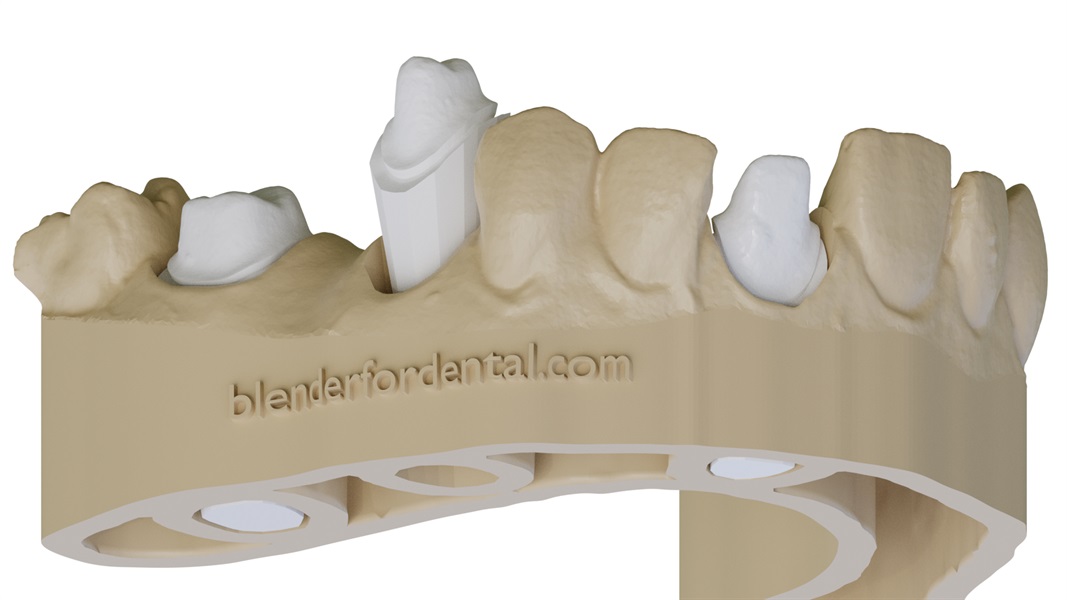 Blender 2.8 add-ons - Dental CAD modules