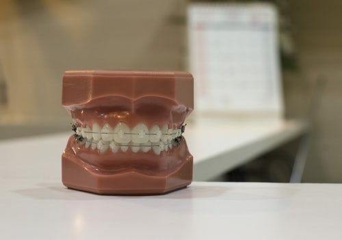 Tooth Polishing for Stubborn Stains