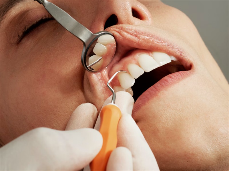 7 Nutritional Strategies for Stronger Teeth and Gums