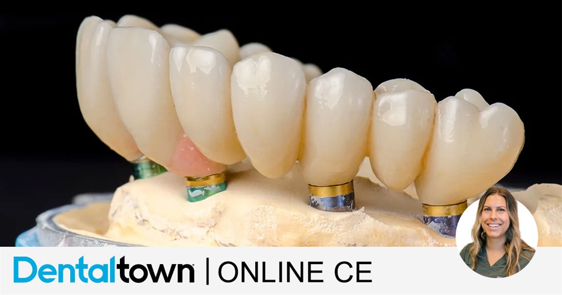 All-On-Four Implant Maintenance (AO4) for Registered Dental Hygienists by Krista Herring